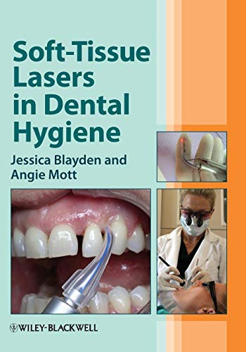 Book Cover Soft-Tissue Lasers in Dental Hygiene