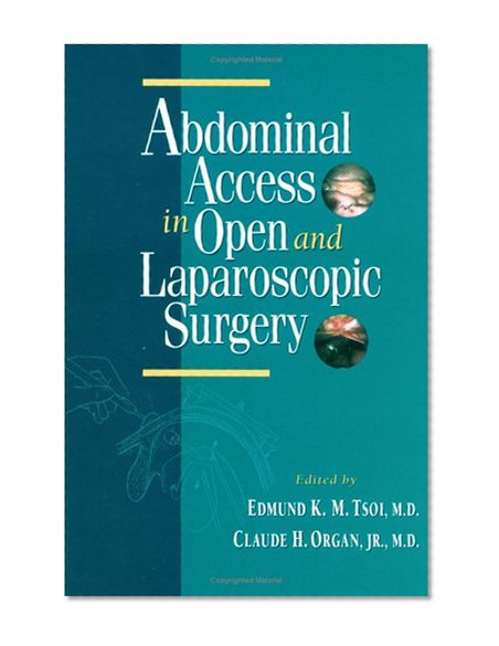 Abdominal Access in Open and Laparoscopic Surgery