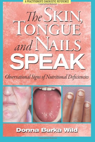 Book Cover The Skin, Tongue and Nails Speak: Observational Signs of Nutritional Deficiencies
