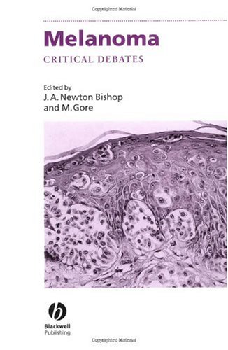 Melanoma: Critical Debates (Challenges In)