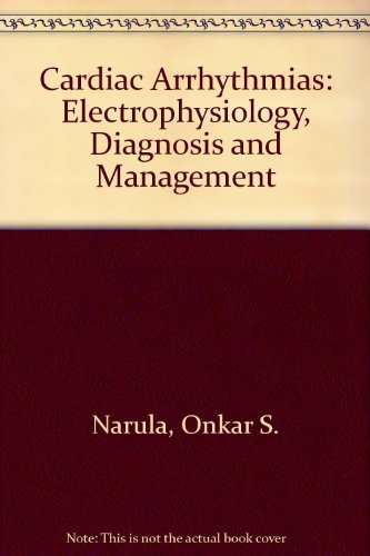 Cardiac arrhythmias: Electrophysiology, diagnosis, and management
