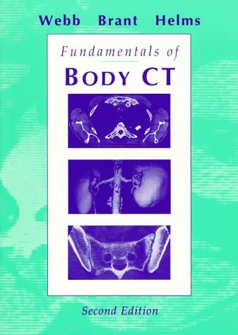 Fundamentals of Body CT, 2e (Fundamentals of Radiology)