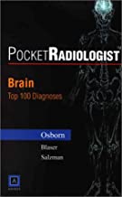 PocketRadiologist: Brain Top 100 Diagnoses
