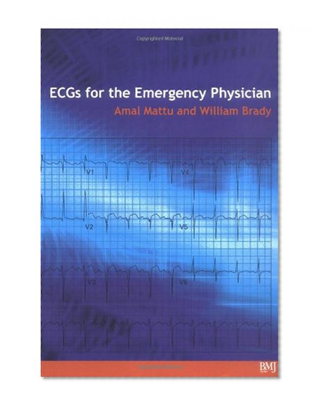 Book Cover ECG's for the Emergency Physician 1