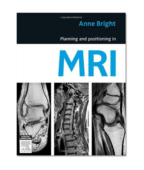 Book Cover Planning and Positioning in MRI, 1e