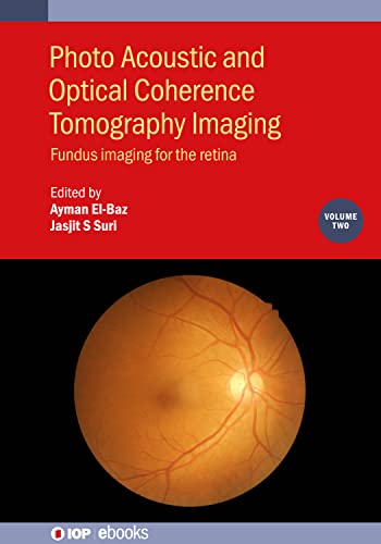 Photo Acoustic and Optical Coherence Tomography Imaging: Fundus Imaging for the Retina (Volume 2)