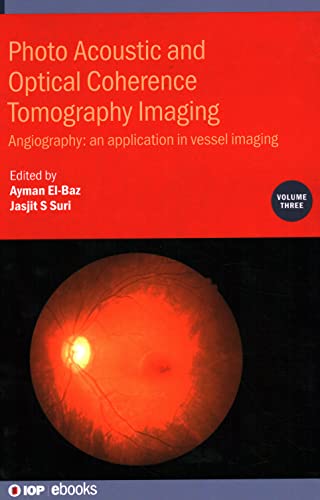 Photo Acoustic and Optical Coherence Tomography Imaging, Volume 3: Angiography: an application in vessel imaging (IOP ebooks)