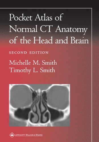 Book Cover Pocket Atlas of Normal CT Anatomy of the Head and Brain (Radiology Pocket Atlas Series)