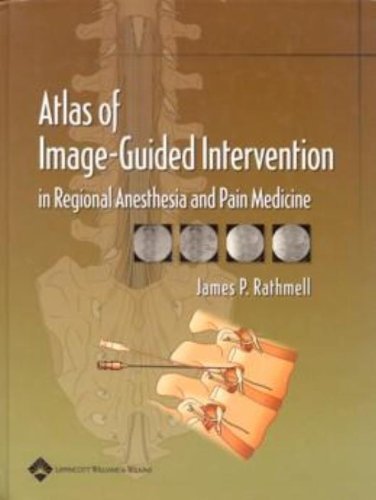 Atlas of Image-Guided Intervention in Regional Anesthesia and Pain Medicine