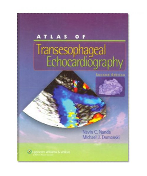Atlas of Transesophageal Echocardiography