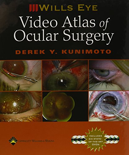 Video Atlas of Ocular Surgery