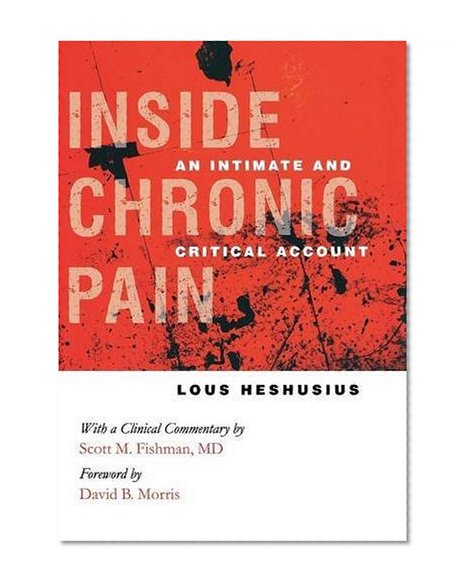 Inside Chronic Pain: An Intimate and Critical Account (The Culture and Politics of Health Care Work)