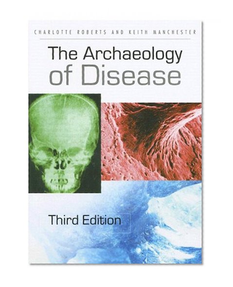 The Archaeology of Disease