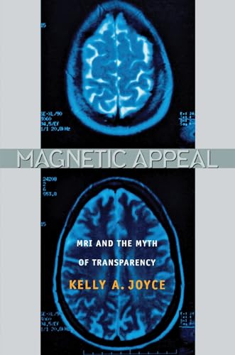 Magnetic Appeal: MRI and the Myth of Transparency