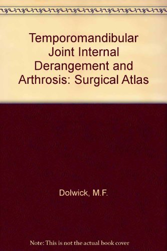 Tmj Internal Derangement & Arthrosis: Surgical Atlas
