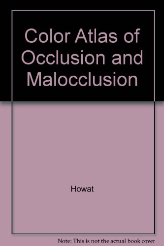 Color Atlas of Occlusion & Malocclusion