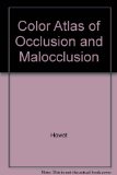 Color Atlas of Occlusion & Malocclusion