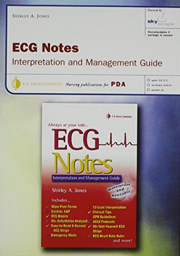 ECG Notes for PDA, based on ECG Notes: Interpretation and Management Guide, powered by Skyscape (CD-ROM version)