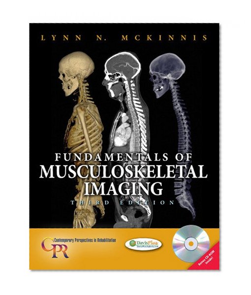 Fundamentals of Musculoskeletal Imaging (Contemporary Perspectives in Rehabilitation)