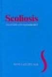 Scoliosis: Diagnosis and Management
