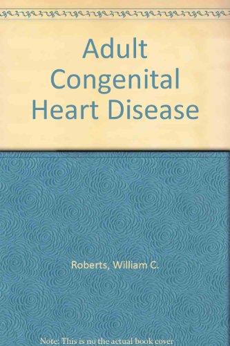 Adult Congenital Heart Disease