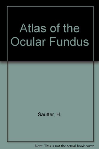 Atlas of the Ocular Fundus