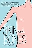 Skin and Bones