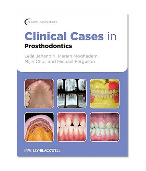 Clinical Cases in Prosthodontics