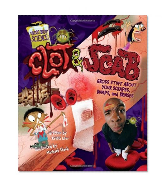 Clot & Scab: Gross Stuff about Your Scrapes, Bumps, and Bruises (Gross Body Science)