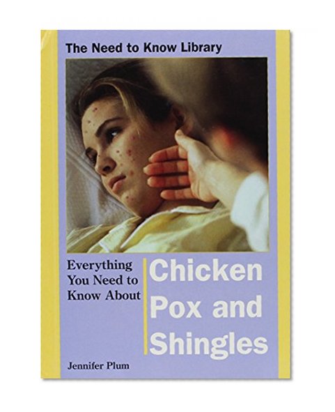 Everything You Need to Know About Chicken Pox and Shingles (Need to Know Library)