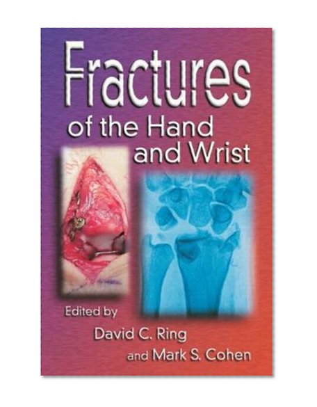 Fractures of the Hand and Wrist