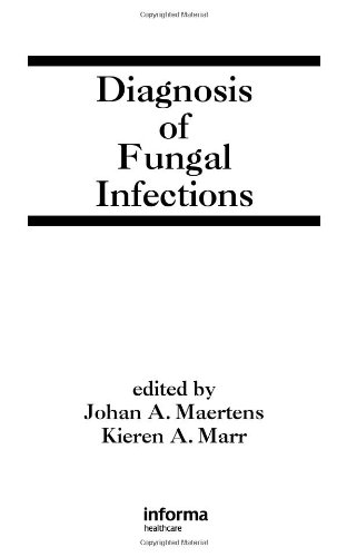 Diagnosis of Fungal Infections (Infectious Disease and Therapy)