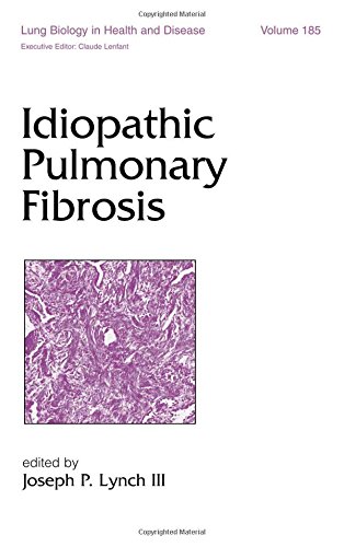 Idiopathic Pulmonary Fibrosis (Lung Biology in Health and Disease)