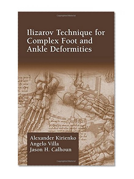 Ilizarov Technique for Complex Foot and Ankle Deformities