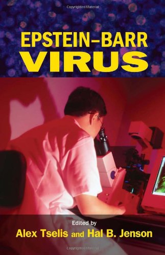 Epstein-Barr Virus (Infectious Disease and Therapy)