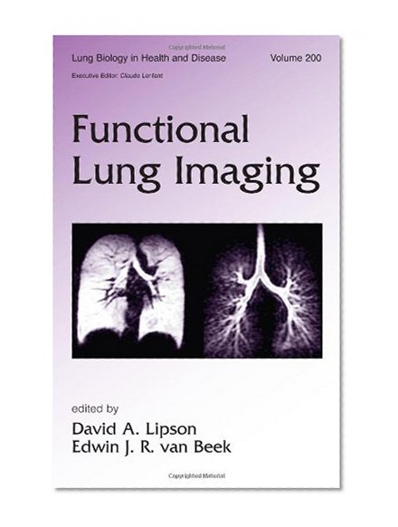 Functional Lung Imaging (Lung Biology in Health and Disease)
