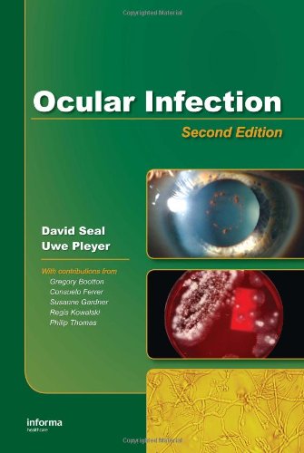 Ocular Infection: Investigation and Treatment in Practice