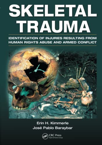 Skeletal Trauma