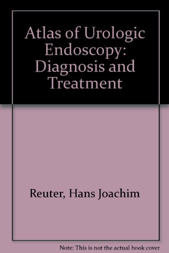Atlas of Urologic Endoscopy: Diagnosis and Treatment