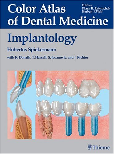 Implantology: Color Atlas of Dental Medicine
