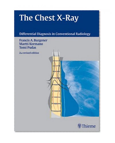 Differential Diagnosis in Chest X-Rays