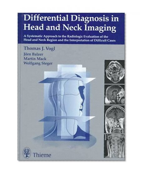 Differential Diagnosis in Head and Neck Imaging