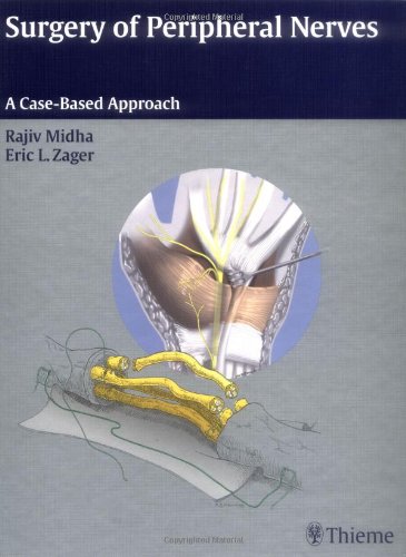 Surgery of Peripheral Nerves