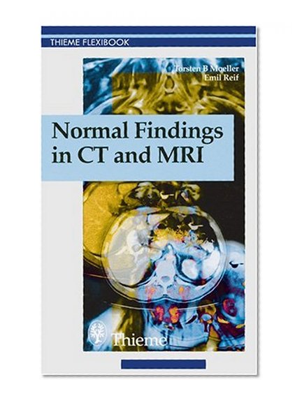 Normal Findings in CT and MRI (Thieme Flexibook)