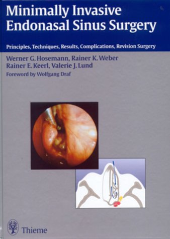 Minimally Invasive Endonasal Sinus Surgery: Principles, Techniques, Results, Complications, Revision Surgery