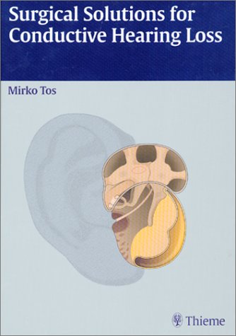 Surgical Solutions for Conductive Hearing Loss: Man Middle Ear Surgery, Volume 4 (Manual of Middle Ear Surgery)