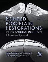 Book Cover Bonded Porcelain Restorations in the Anterior Dentition: A Biomimetic Approach