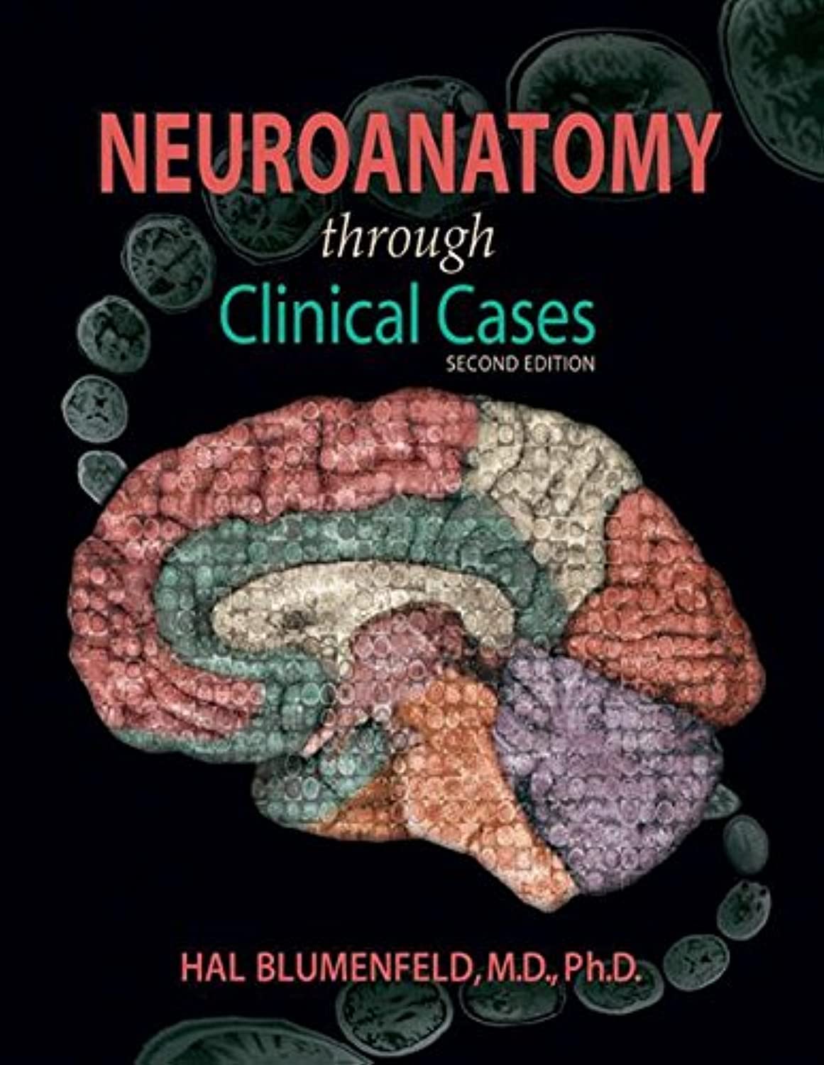 Book Cover Neuroanatomy through Clinical Cases