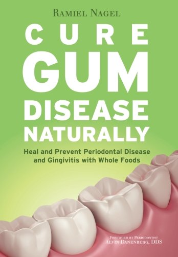 Book Cover Cure Gum Disease Naturally: Heal and Prevent Periodontal Disease and Gingivitis with Whole Foods