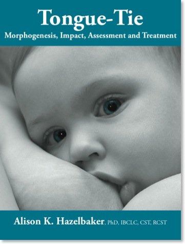 Book Cover TONGUE TIE Morphogenesis, Impact, Assessment and Treatment.